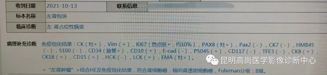 高尚病例:63 岁女性日常无症状,体检发现左肾癌