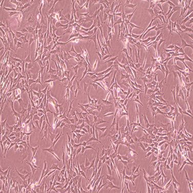 小鼠肾小管上皮细胞；TCMK-1