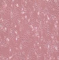 小鼠肾小管上皮细胞；TCMK-1