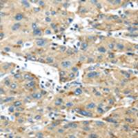 兔抗ISM2多克隆抗体