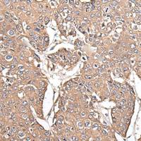 兔抗KRT73多克隆抗体