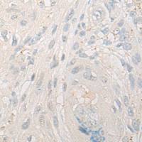 兔抗HOXA1多克隆抗体