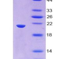 鳞状细胞癌抗原1(SERPINB3)重组蛋白(多属种)