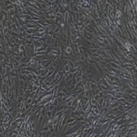 Ⅱ型肺泡上皮细胞