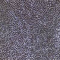 前列腺成纤维细胞