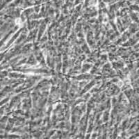 输卵管上皮细胞