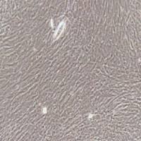 膀胱平滑肌细胞