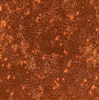 子宫内膜上皮细胞