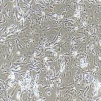 输尿管上皮细胞