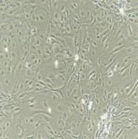 甲状腺上皮细胞