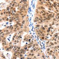 兔抗LRP5多克隆抗体