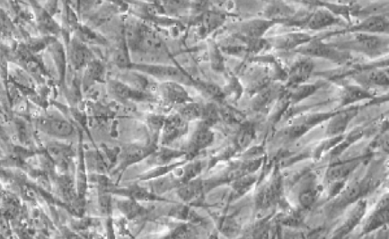 乳腺成纤维细胞