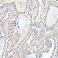 兔抗KCNA3多克隆抗体