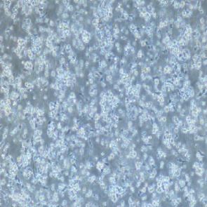 外周血单个核细胞