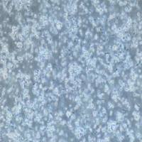 外周血单个核细胞