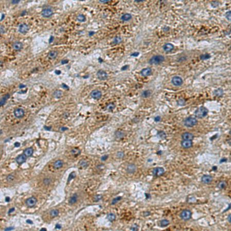 兔抗FOXS1多克隆抗体