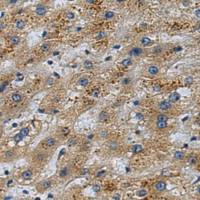 兔抗FOXS1多克隆抗体