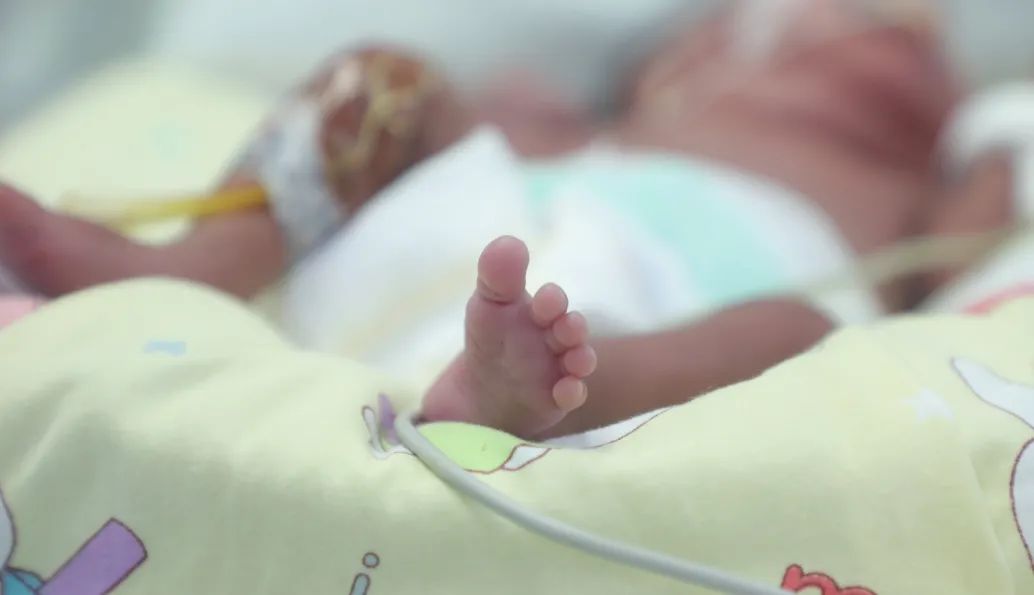 快！23 周早产！1.4 斤的「巴掌宝宝」生命闯关！