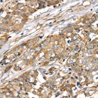 兔抗LONP1多克隆抗体