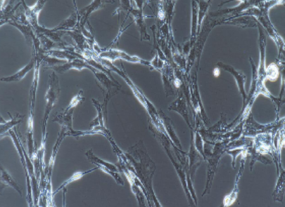 人视网膜微血管内皮细胞