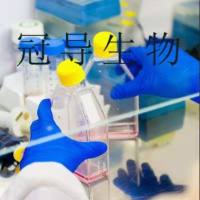 JEM493 Cell;JEM493细胞系(STR鉴定图谱