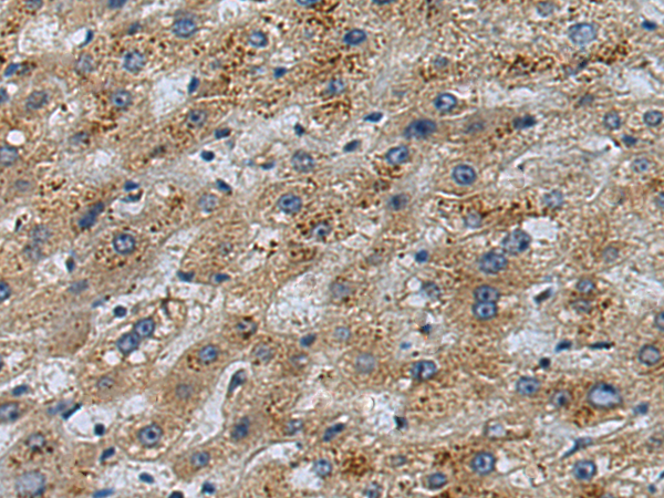 兔抗FOXS1多克隆抗体