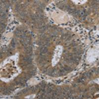 兔抗HSD3B1多克隆抗体