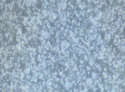 外周血单个核细胞