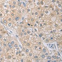 兔抗IL1RN多克隆抗体