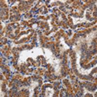 兔抗KLK6多克隆抗体