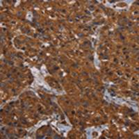 兔抗HYAL2多克隆抗体