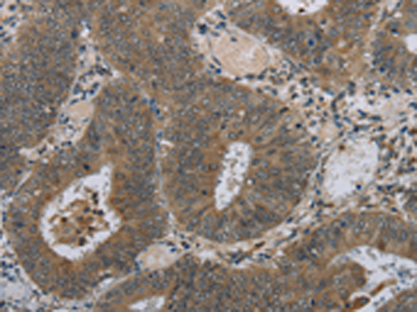 兔抗HSD3B1多克隆抗体