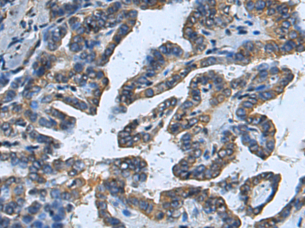 兔抗FOXS1多克隆抗体