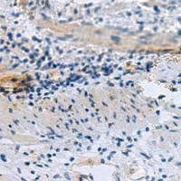 兔抗GSPT1多克隆抗体