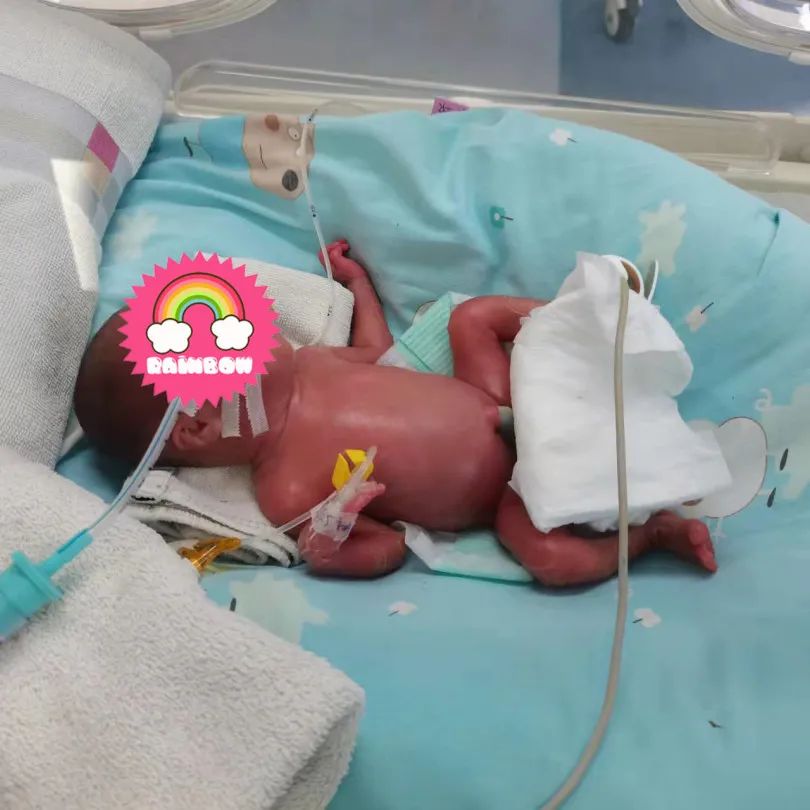 快！23 周早产！1.4 斤的「巴掌宝宝」生命闯关！