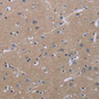 兔抗KLHL2多克隆抗体