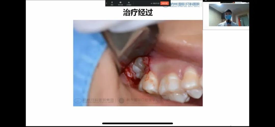 杭州牙科医院集团 2021 年度病例交流讨论会正式开始