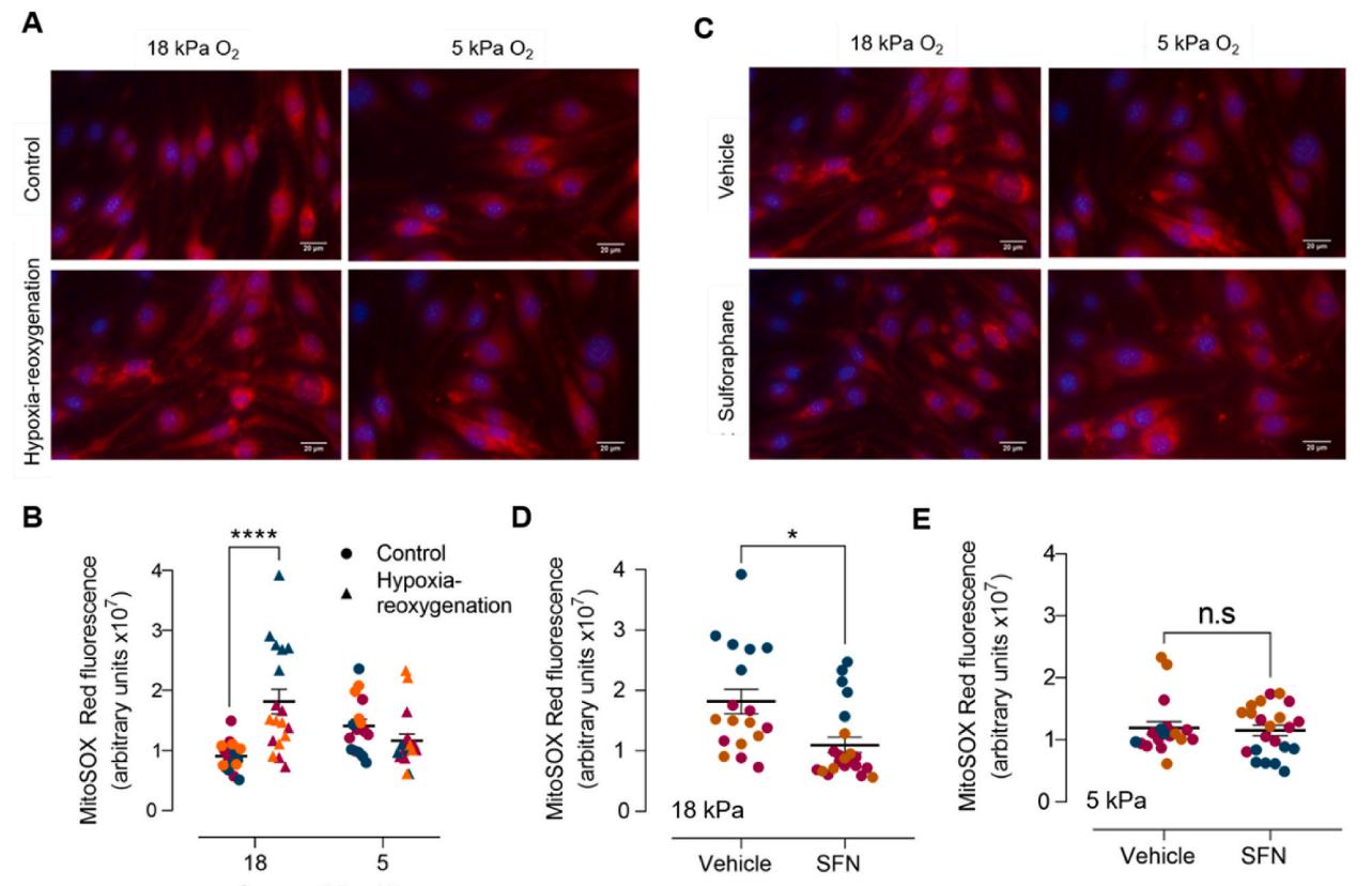 低氧/厌氧产品案例——低氧与脑血管内皮细胞研究