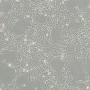 人星形胶质细胞HA