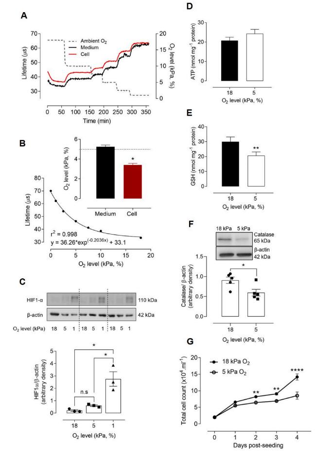 低氧/厌氧产品案例——低氧与脑血管内皮细胞研究