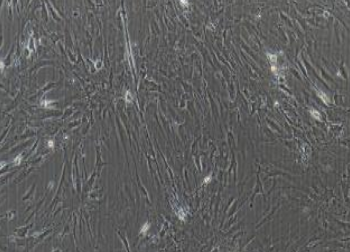 人脑神经胶质细胞