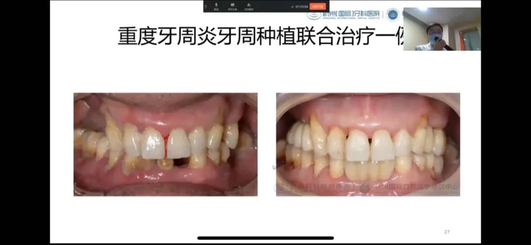 杭州牙科医院集团 2021 年度病例交流讨论会正式开始