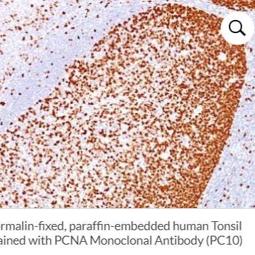 PCNA单克隆小鼠抗体 (PC10),碱性磷酸酶,100ul BNCAP0467-100