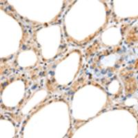 兔抗RAB11A多克隆抗体