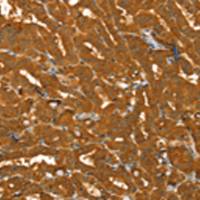 兔抗PYGM多克隆抗体