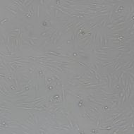 小鼠髓系白血病细胞M1
