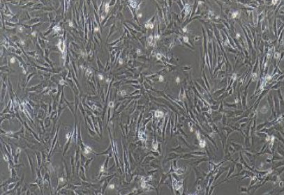 主动脉平滑肌细胞