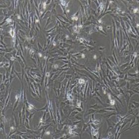 主动脉平滑肌细胞