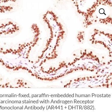 雄激素受体单克隆小鼠抗体 (AR441 + DHTR/882) BNCAP0913-500