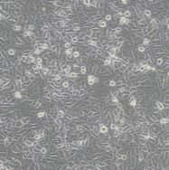 人视网膜微血管内皮细胞HRCEC